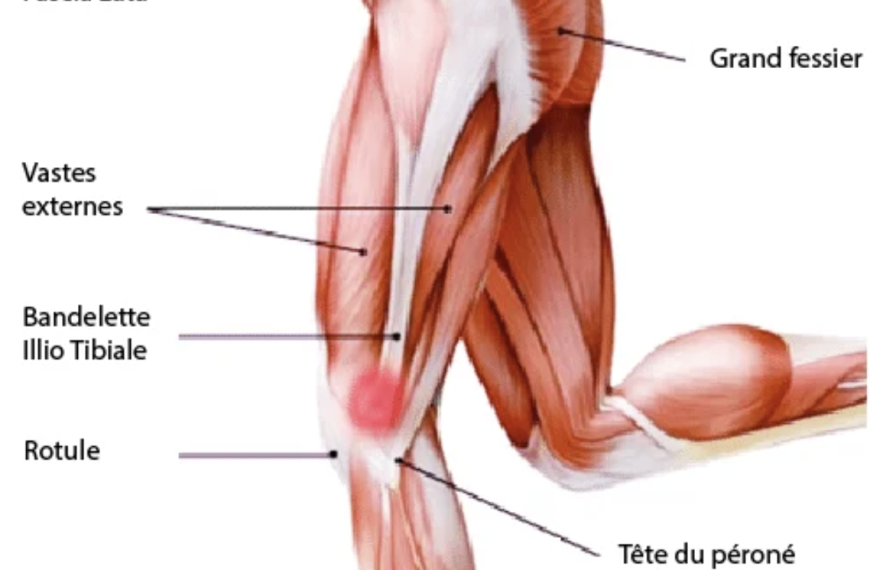 Le Syndrome de l’essuie-glace : définition, causes, solutions